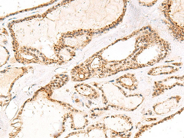 DCAF10 Polyclonal Antibody (E-AB-52857)