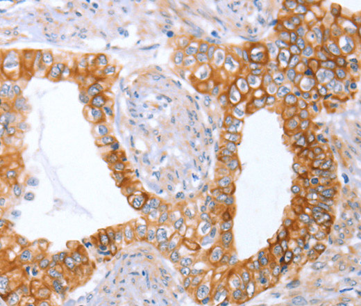 ABO Polyclonal Antibody (E-AB-13092)