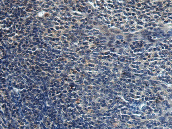 HAUS6 Polyclonal Antibody (E-AB-19250)