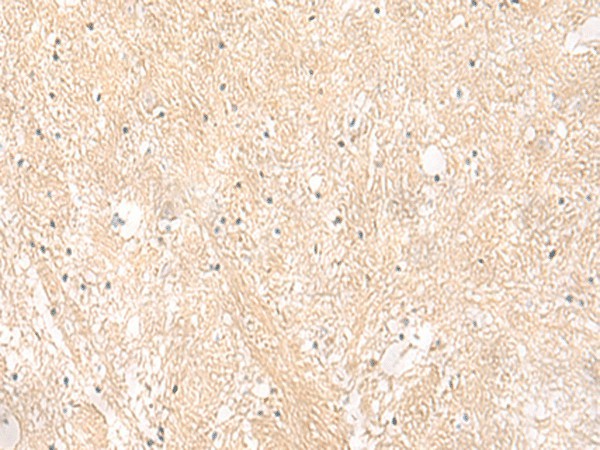 EMC1 Polyclonal Antibody (E-AB-52791)