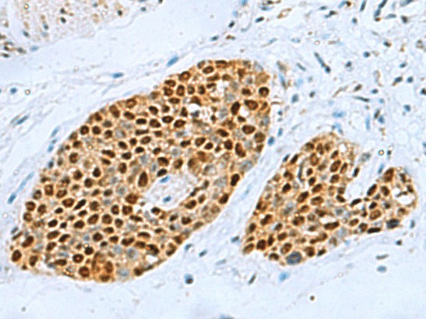 TFAP4 Polyclonal Antibody (E-AB-19234)