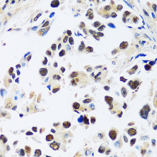 ASCL4 Polyclonal Antibody (E-AB-65006)