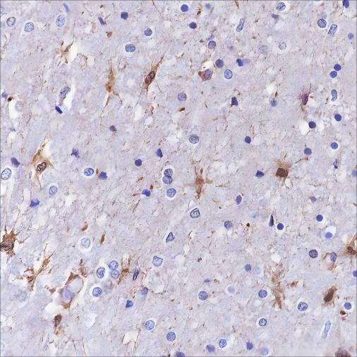 Recombinant S100A13 Monoclonal Antibody (AN301650L)
