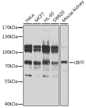 UBTF Polyclonal Antibody (E-AB-92999)