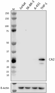 Purified anti-Carbonic Anhydrase 2 (CA2) Antibody (654451)