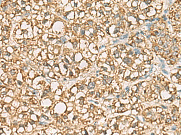 VTA1 Polyclonal Antibody (E-AB-53134)