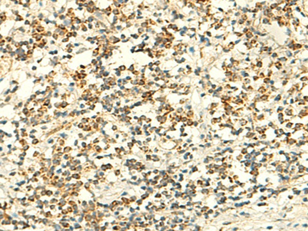 IFT27 Polyclonal Antibody (E-AB-18926)