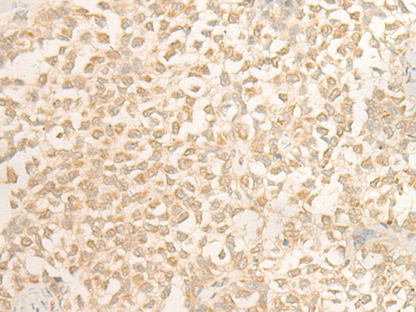 DUSP27 Polyclonal Antibody (E-AB-17896)
