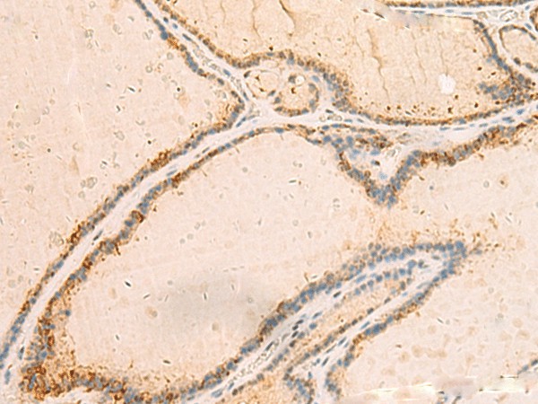 IP6K3 Polyclonal Antibody (E-AB-18106)