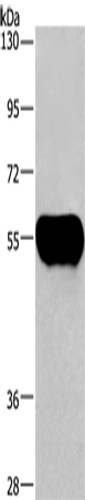 AHSG Polyclonal Antibody (E-AB-14547)