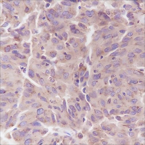 Recombinant PI3 Kinase p85 alpha Monoclonal Antibody (AN301629L)