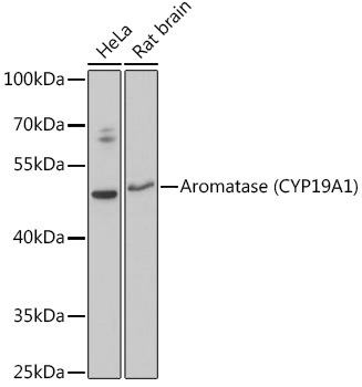 Aromatase Polyclonal Antibody (E-AB-68290)