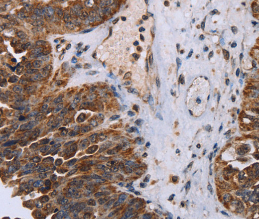 DDX11 Polyclonal Antibody (E-AB-15165)
