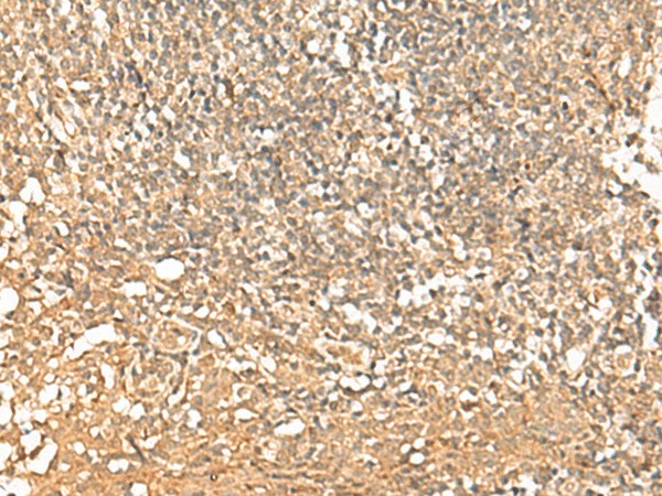 PWP1 Polyclonal Antibody (E-AB-52755)