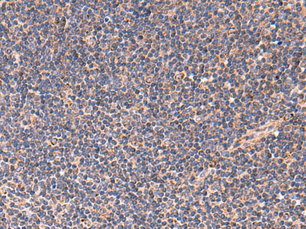 TNF Polyclonal Antibody (E-AB-52066)