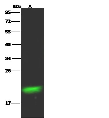 Recombinant RBP4 Monoclonal Antibody (AN300486P)