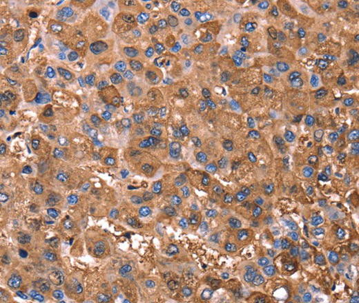 ERN2 Polyclonal Antibody (E-AB-16413)