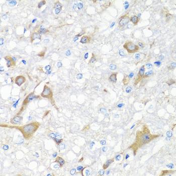 IL22 Polyclonal Antibody (E-AB-67738)