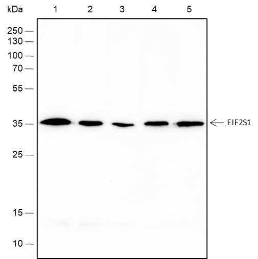 Recombinant EIF2S1 Monoclonal Antibody (AN301512L)