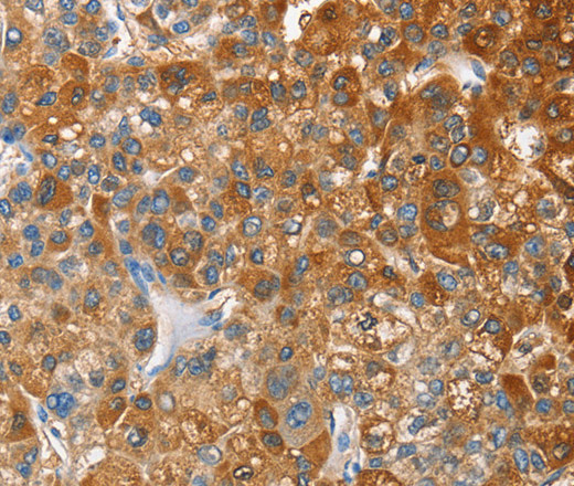 OX2R Polyclonal Antibody (E-AB-14842)
