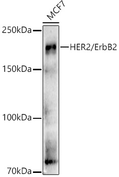 (KO Validated) HER2/ErbB2 Polyclonal Antibody (E-AB-93336)