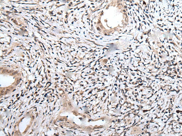 UBN1 Polyclonal Antibody (E-AB-53572)