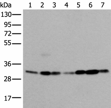 VDAC1 Polyclonal Antibody (E-AB-52417)