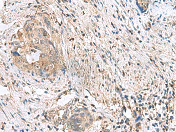 STK32A Polyclonal Antibody (E-AB-53053)