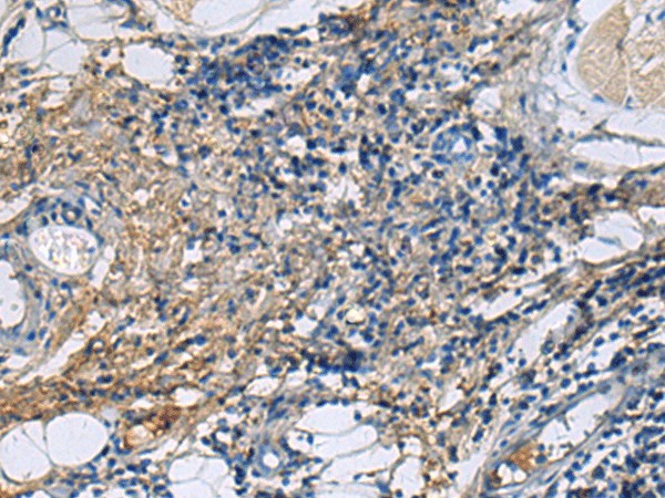 PROC Polyclonal Antibody (E-AB-19808)