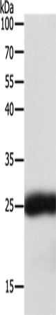 SNAP25 Polyclonal Antibody (E-AB-14354)