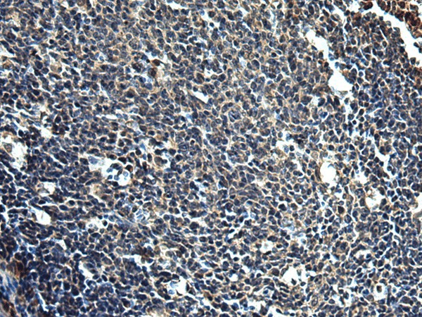 PRRT2 Polyclonal Antibody (E-AB-53151)