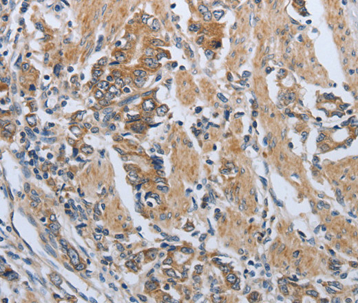 PD-1/CD279 Polyclonal Antibody (E-AB-12838)