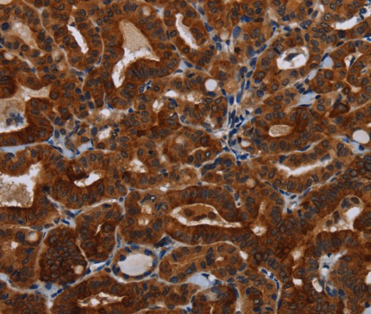 KLHL1 Polyclonal Antibody (E-AB-15159)