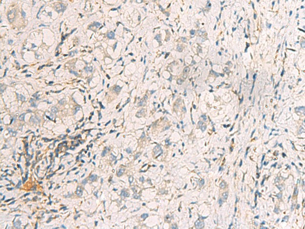 SUSD3 Polyclonal Antibody (E-AB-19198)
