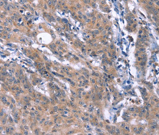 ESPL1 Polyclonal Antibody (E-AB-16415)