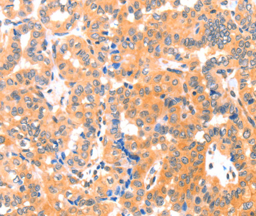 THBS1 Polyclonal Antibody (E-AB-16211)