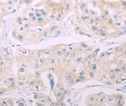ADCY7 Polyclonal Antibody (E-AB-12951)