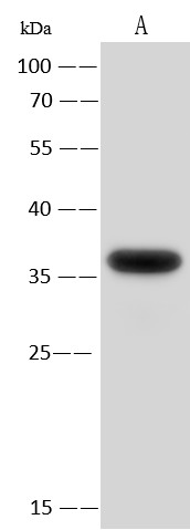 EMAPII/AIMP1 Monoclonal Antibody (AN200182P)