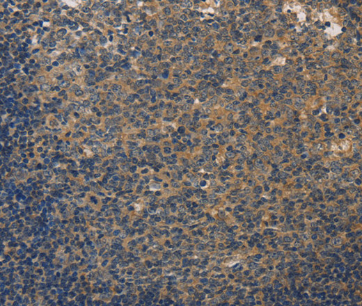 DUSP26 Polyclonal Antibody (E-AB-14965)