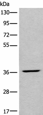 LDAH Polyclonal Antibody (E-AB-19643)
