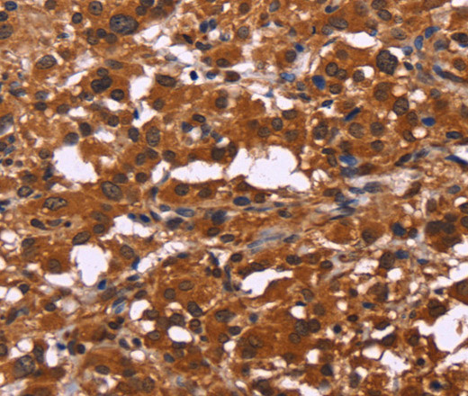 ART5 Polyclonal Antibody (E-AB-14634)