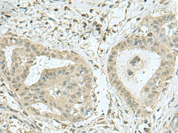 THTPA Polyclonal Antibody (E-AB-18952)