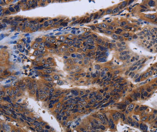 HTR2B Polyclonal Antibody (E-AB-10115)