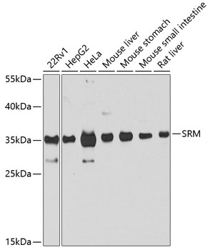 SRM Polyclonal Antibody (E-AB-62224)