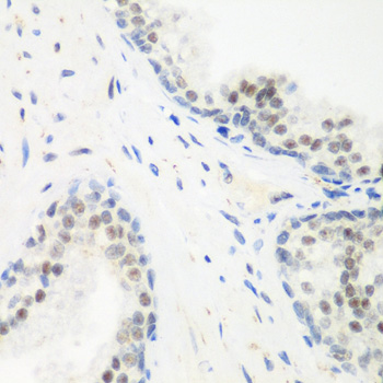 PPAN Polyclonal Antibody (E-AB-61678)