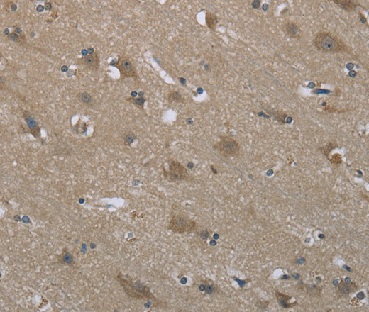 SYT3 Polyclonal Antibody (E-AB-14372)