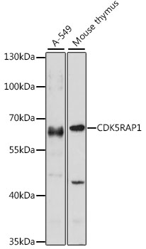 CDK5RAP1 Polyclonal Antibody (E-AB-66603)