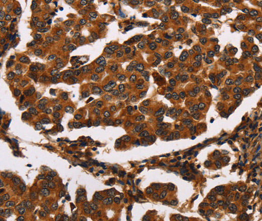 ARSB Polyclonal Antibody (E-AB-16264)