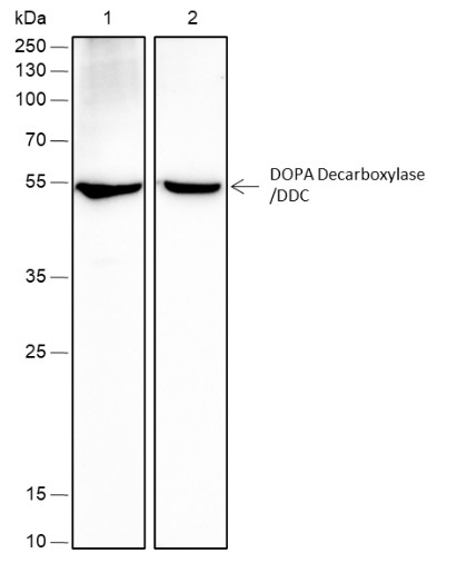 Recombinant DOPA Decarboxylase/DDC Monoclonal Antibody (AN301705L)