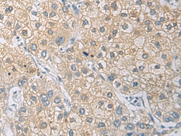 IL1RN Polyclonal Antibody (E-AB-19510)